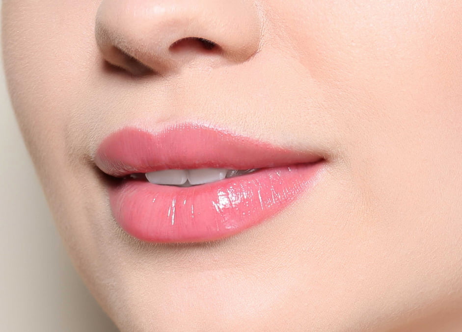 belotero-lip-after-photo1-img