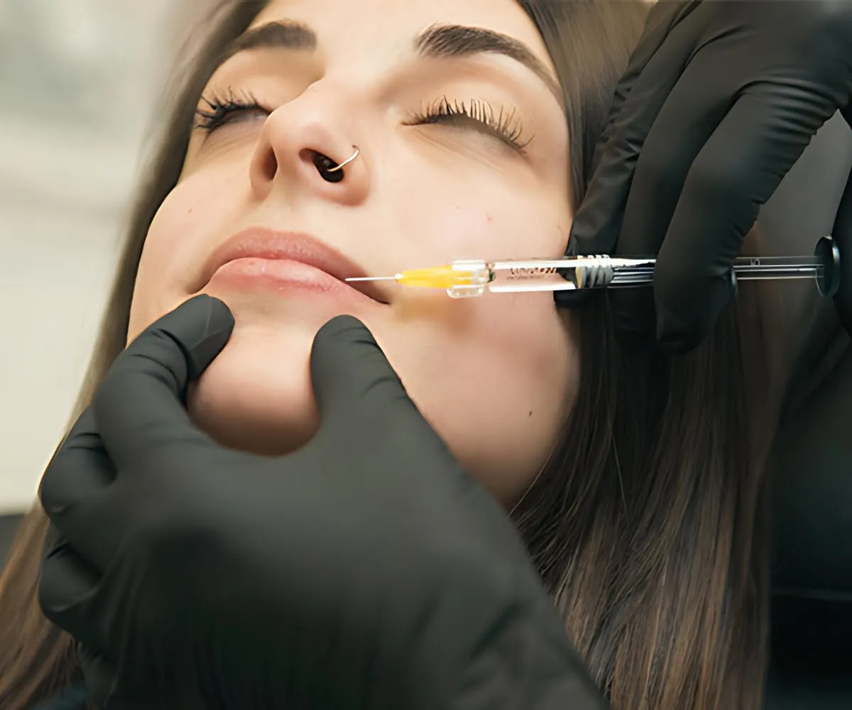 xeomin-lip-flip-non-filler-treatment-buffalo-img